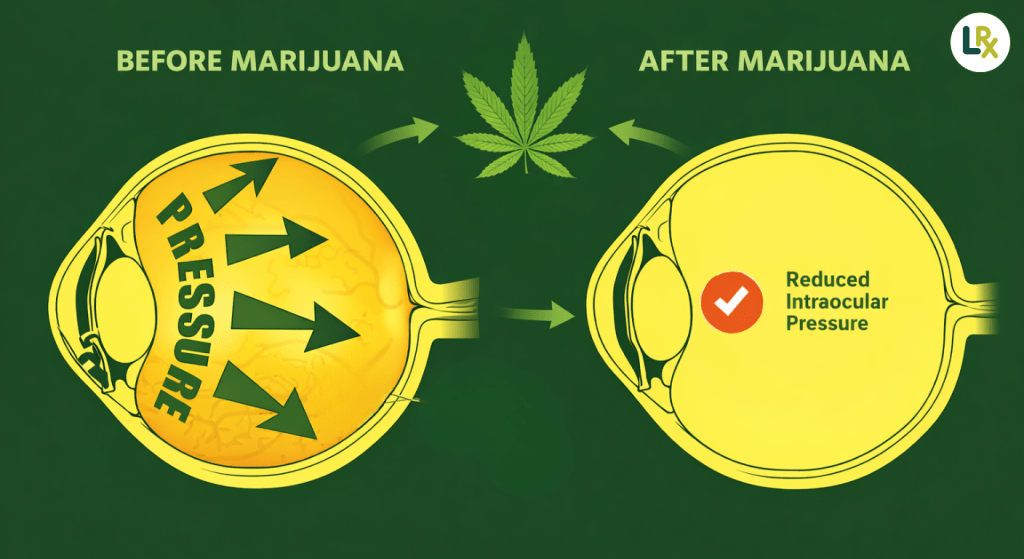 the science behind cannabis for glaucoma